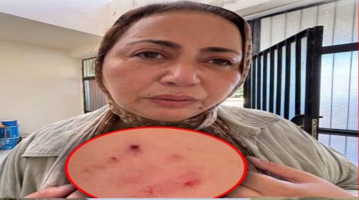 اعتداء على صحافية «شوف تيفي» يعيد ملف حماية الصحافيين إلى الواجهة